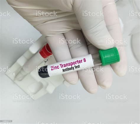 zn blood test samples